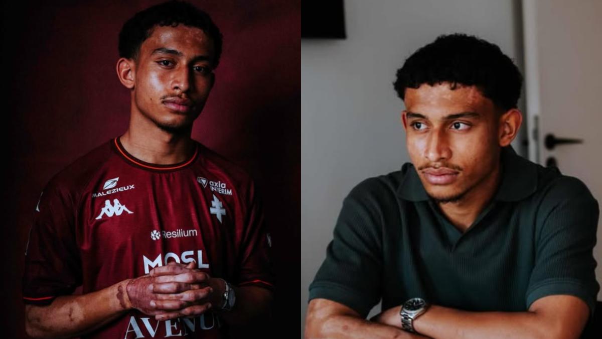 Firma con el Metz tras rescatar a su novia de un incendio mortal que le dejó quemaduras en el 30% de su cuerpo