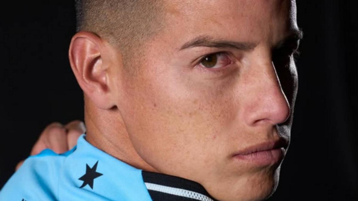 Desmienten que James Rodríguez sufra rabdomiólisis, una enfermedad potencialmente mortal